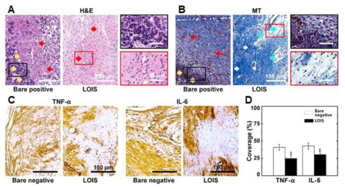 감염 및 염증반응 평가 결과. A) Hematoxylin&Eosin (H&E) 염색, B) Masson’s trichrome (MT) 염색, C) 면역 염색 2종 (TNF-α 및 IL-6) 발현 양상 및 D) 비교 분석