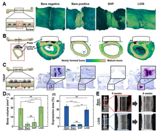 Micro-CT 및 X-ray로 보는 골 재생 양상. A) Micro-CT 측면 촬영 양상, B) Micro-CT 절단면 촬영 양상, C) TRAP 염색을 통한 파골세포 분포 양상 및 D) 골재생 분석. E) X-ray 촬영 양상 (수술 6주 후)