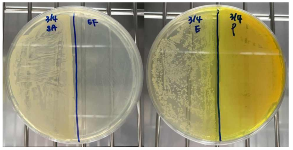 Optimization of the concentration of bacteria solution for colony counting method