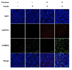 Hsd17b4 KO에 의한 in vitro 지방간 및 인슐린 저항성 개선 효과 분석 결과