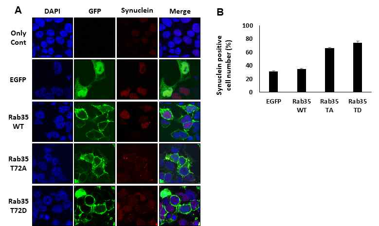 Rab35 WT, T72A, 및 T72D에 의한 세포 내 α-synuclein 응집체 변화를 분석