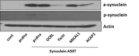 Rab35 effector에 의한 α -synuclein 발현 및 인산화 변화를 분석
