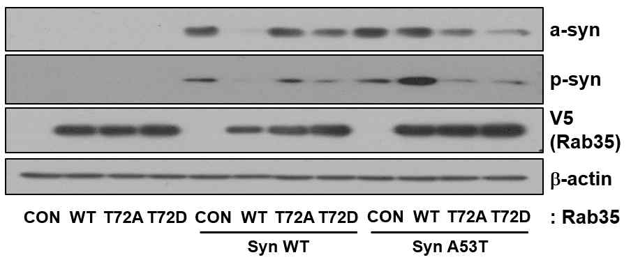 Rab35 인산화에 의한 α-synuclein 발현 및 인산화 연계성 분석