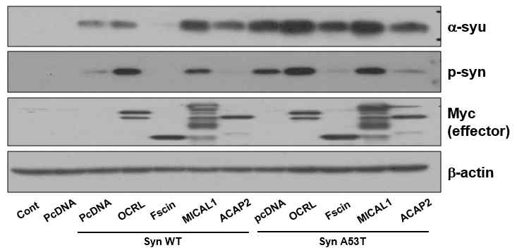 Rab35 effector들에 의한 α-synuclein 발현 및 인산화 변화 분석