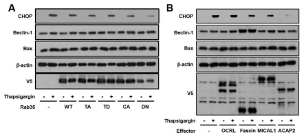 Golgi-ER stress 환경에서의 RAB35 및 이의 effector 단백질의 기능 분석