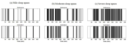 수면 무호흡 정도에 따른 알고리즘 결과 비교 예