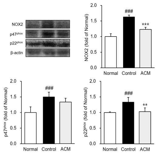 NADPH oxidase 발현량 분석