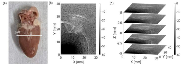 (a) 생체 조직 phantom (닭의 심장) (b) 2차원 이미지(Z=0) (c) 3차원 이미지