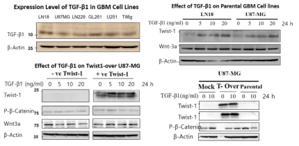 TGF-beta를 투여하였을 때 Twist1의 발현변화 및 관련 신호전달 체계 유전자 발현변화를 확인하였음