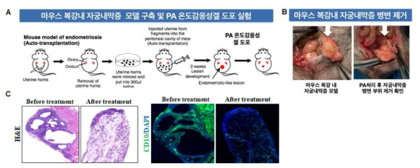 PA 함유 온도 감응성 겔 제제를 이용한 자궁내막증 치료 효능 확인. (A). 자궁내막증 마우스 모델 구축, (B). 마우스 복강 내 자궁내막증 병변 부위에 PA 함유 온도 감응성 겔 제제 도포, (C). H&E, CD10 statining을 통한 치료 효과 확인