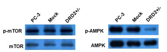 DRD2+/- PC-3 세포의 AMPK 인산화 감소