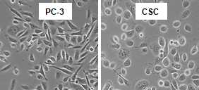 PC-3와 PC-3 유래 암줄기 세포 형태 비교