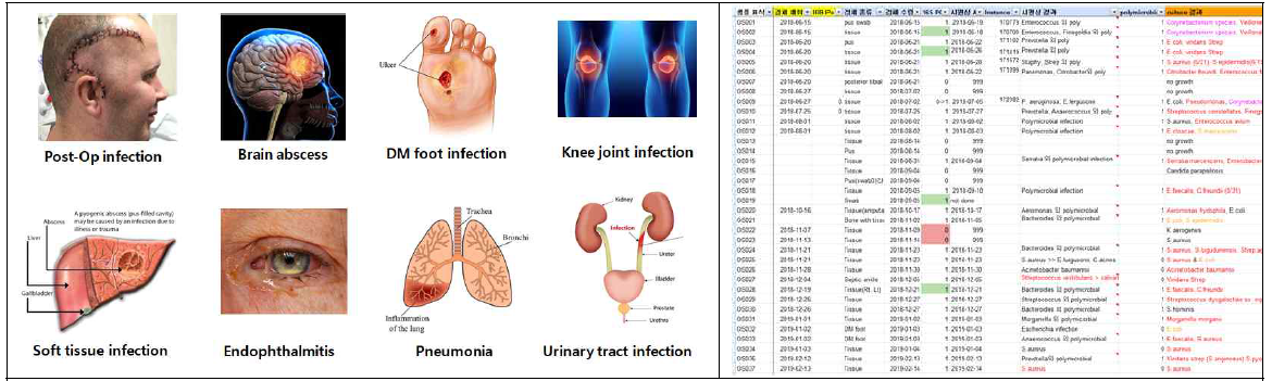 다양한 감염성 질환에서 임상검체 데이터베이스를 구축하였음