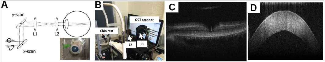 (A) 안구 측정을 위한 스캐너 구성도 및 적출된 돼지 눈알, (B) 1차 제작 망막 측정 스캐너, (C) 1차 획득된 망막 영상, (D) 획득된 각막 영상