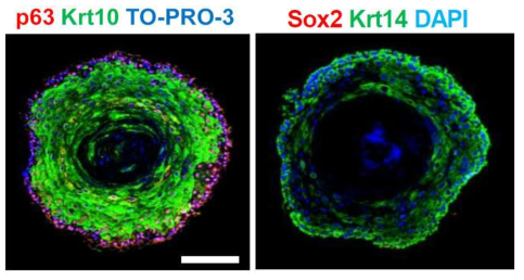 mDEO의 basal cell (p63), suprabasal cell (Krt10), stemness (Sox2) marker 염색