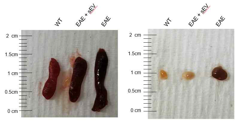 EAE 마우스 모델과 MSC 엑소좀을 처리한 마우스의 2차 림프조직인 비장과 림프절의 크기 비교 사진