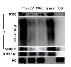 thymocyte에 MSC-엑소좀과 p300 억제제를 처리했을 때 K63의acetylation과 polyubiquitination의 발현양 비교