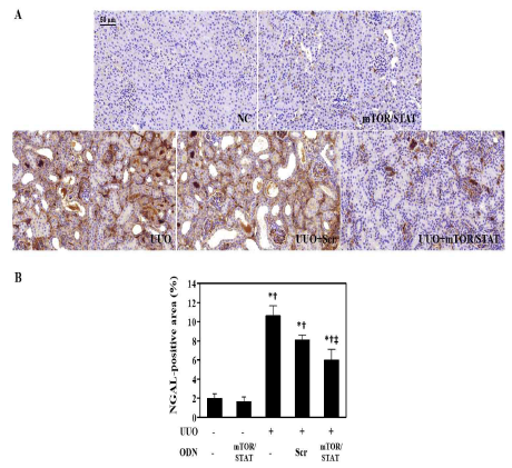 합성 mTOR/STAT3 ODN에 의한 NGAL의 발현 변화. (A) NGAL 면역조직화학염색; (B) NGAL 면역조직화학염색 % 면적 그래프