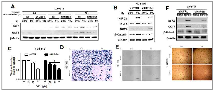 저산소 유도 TIC 발달에 대한 HIF-2α의 역할. 장기간 저산소 배양에 따른 TIC 마커의 증가(A), HIF-2α 억제 후 TIC 마커의 감소(B), 항암제 저항성 감소(C), 전이능 감소(D), 성장 감소(E), 및 sphere 형 성능 억제 (F)