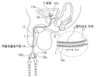 요도 억제 장치 인체 적용 모식도