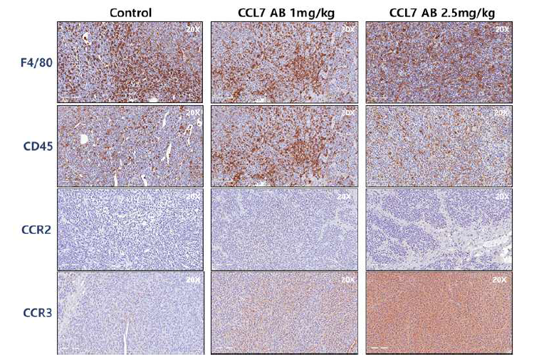 CCL7 neutralizing antibody 처리 후 간전이 조직에서의 면역세포 및 CCL7 receptor 발현 확인
