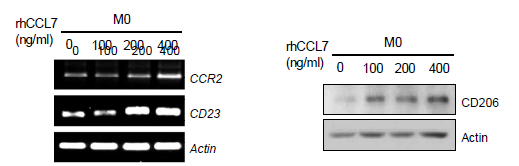 CCL7 이 TAM 분화에 미치는 영향