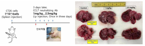 CCL7 neutralizing antibody에 의한 간전이 억제 효과 검증 동물 실험