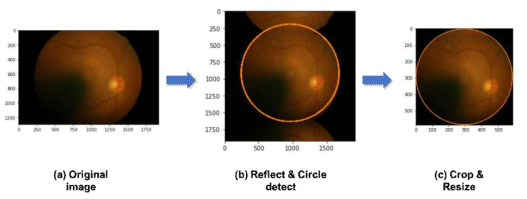 원형의 망막영상을 감지하여 추출하는 전처리 과정