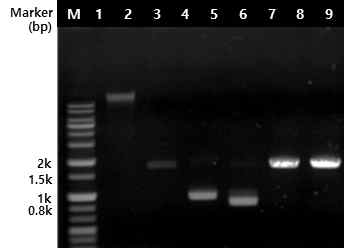 균주의 유전자 획득 및 PCR 증폭 결과