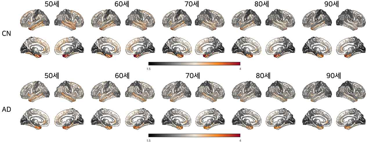 선형 generative 모델 기반 치매 latent 공간에서의 interpolation 결과