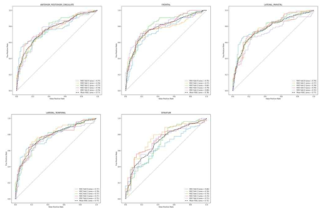 영역별 아밀로이드 양성/음성 예측 결과 (윗줄 왼쪽부터: anterior/posterior cingulate region, frontal region, lateral parietal region; 아랫줄 왼쪽부터: lateral temporal region, striatum region)