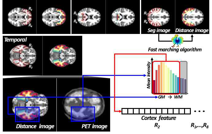 Amyloid PET의 Curved feature 정의 예