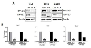 바이오 플라즈마에 의한 HPV의 종양단백질 E6/E7의 활성조절 (A) western blotting (B) 정량그래프