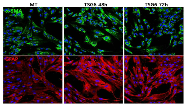 Pancreatic stellate cell에 TSG6 단백질 처리 후 활성화 변화 패턴 관찰