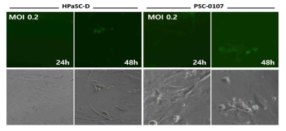 각종 PSC에서 VSV-GFP 감염 후 GFP 발현 패턴 비교