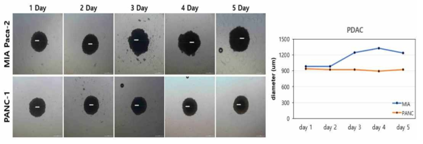 췌장암 세포주 종류에 따른 Hanging drop 모델의 직경 변화 비교