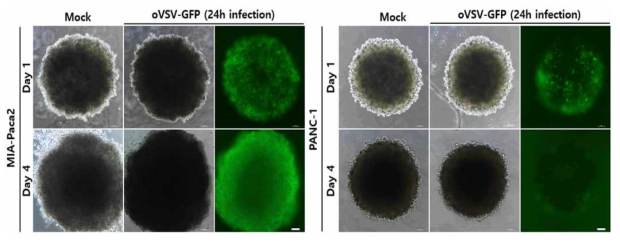Hanging drop 암 오가노이드에서 VSV-GFP 바이러스 감염패턴 관찰