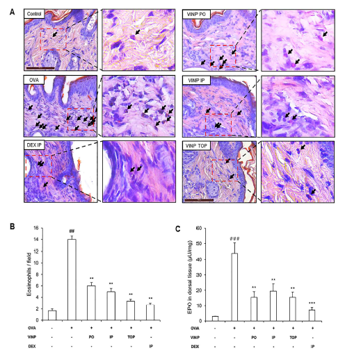 Eosinophil infiltration and peroxidase (EPO) activity in the dorsal skin tissue