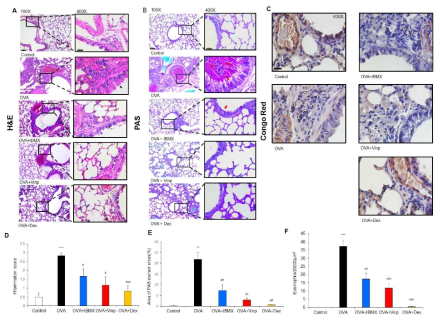 IBMX and Vinpocetine inhibited the histological changes induced by ovalbumin