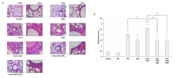 Effect of PDE7 inhibitor on OVA-induced pathological changes to the antigen challenge in the mouse lung tissue co-exposed with ASD