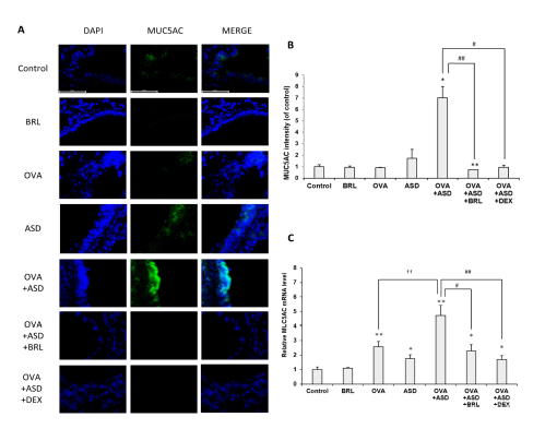 MUC5AC production in ASD-exacerbated asthmatic lung tissue