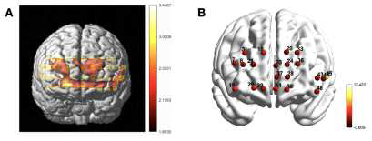 Brain activation of the accommodation