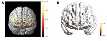 Brain activation of the assimilation