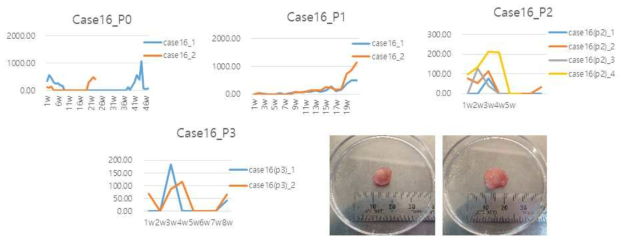 방광암 이종이식 모델 case 16번의 3차 계대 성장 곡선