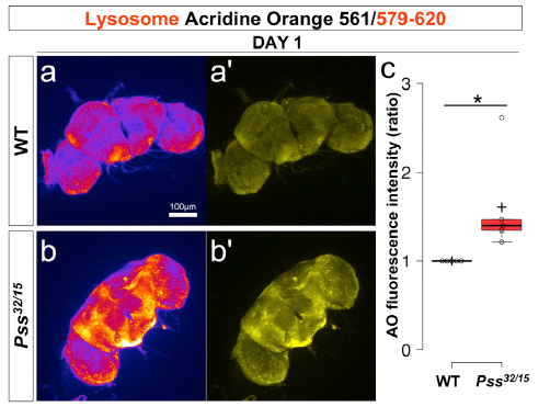 AO 염색을 통한 lysosome 확인