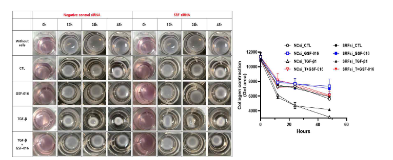 SRF 저발현에 의한 IPF 세포의 collagen gel contraction 확인