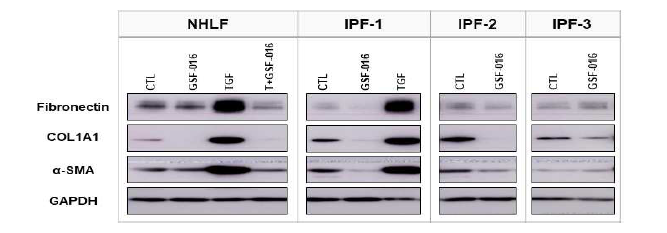 IPF 환자 유래 섬유아세포주에서 GSF-016처리에 따른 fibrogenesis 관련 단백질들의 발현 변화