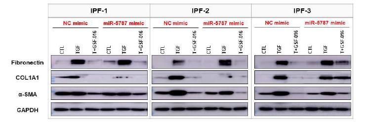 IPF 환자 유래 섬유아세포주에서 miR-5787 과발현에 의한 fibrogenesis 관련 단백질들의 발현 변화