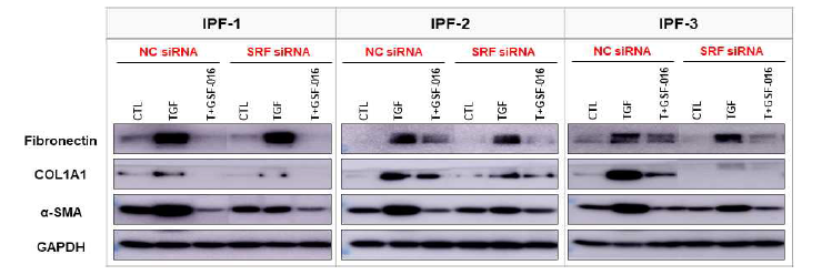 IPF 환자 유래 섬유아세포주에서 SRF 저발현에 의한 fibrogenesis 관련 단백질들의 발현 변화