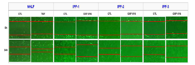IPF 환자 유래 섬유아세포주에서 GSF-016처리에 의해 migration에 미치는 영향